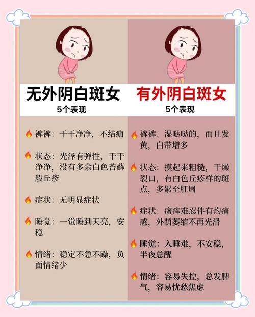 白斑病是妇科病吗-白斑是妇科病还是皮肤病