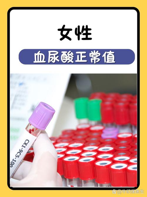 尿酸的正常值范围是多少-女性尿酸的正常值范围是多少