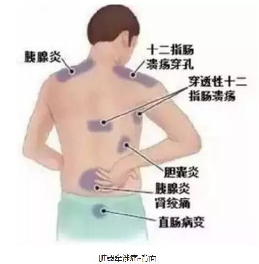 身体器官什么部位缩写是TG的简单介绍