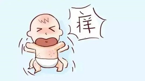 去除婴儿热疹小妙招_小孩湿疹反反复复怎么根除