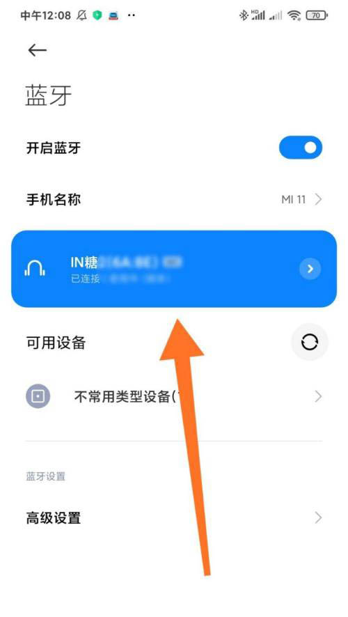 手机梯子加速器怎么使用的教程_手机梯子加速器怎么使用的教程图解