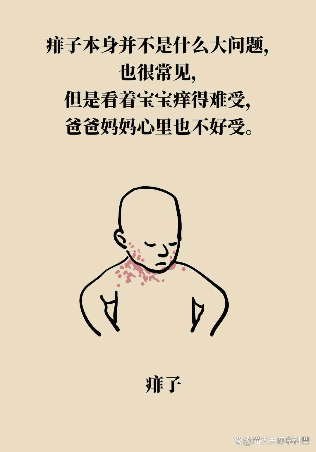 儿童去痱子止痒最有效的方法-儿童去痱子止痒最有效的方法有哪些
